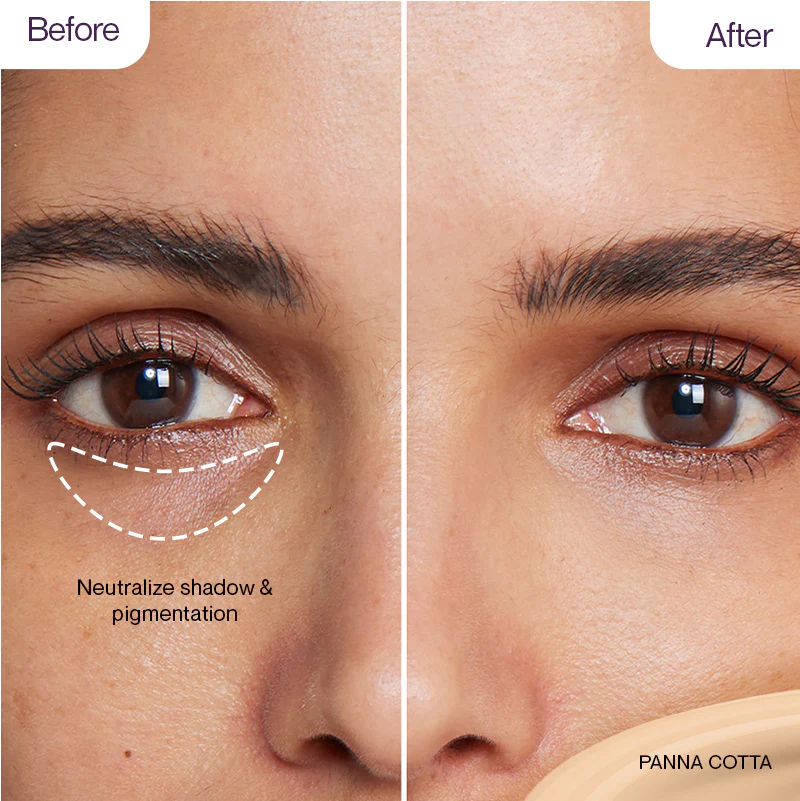 Product image 100